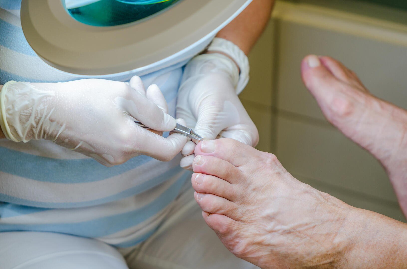 Ein Podologe, der Handschuhe trägt, schneidet mit einer Metallzange den Zehennagel eines Patienten.