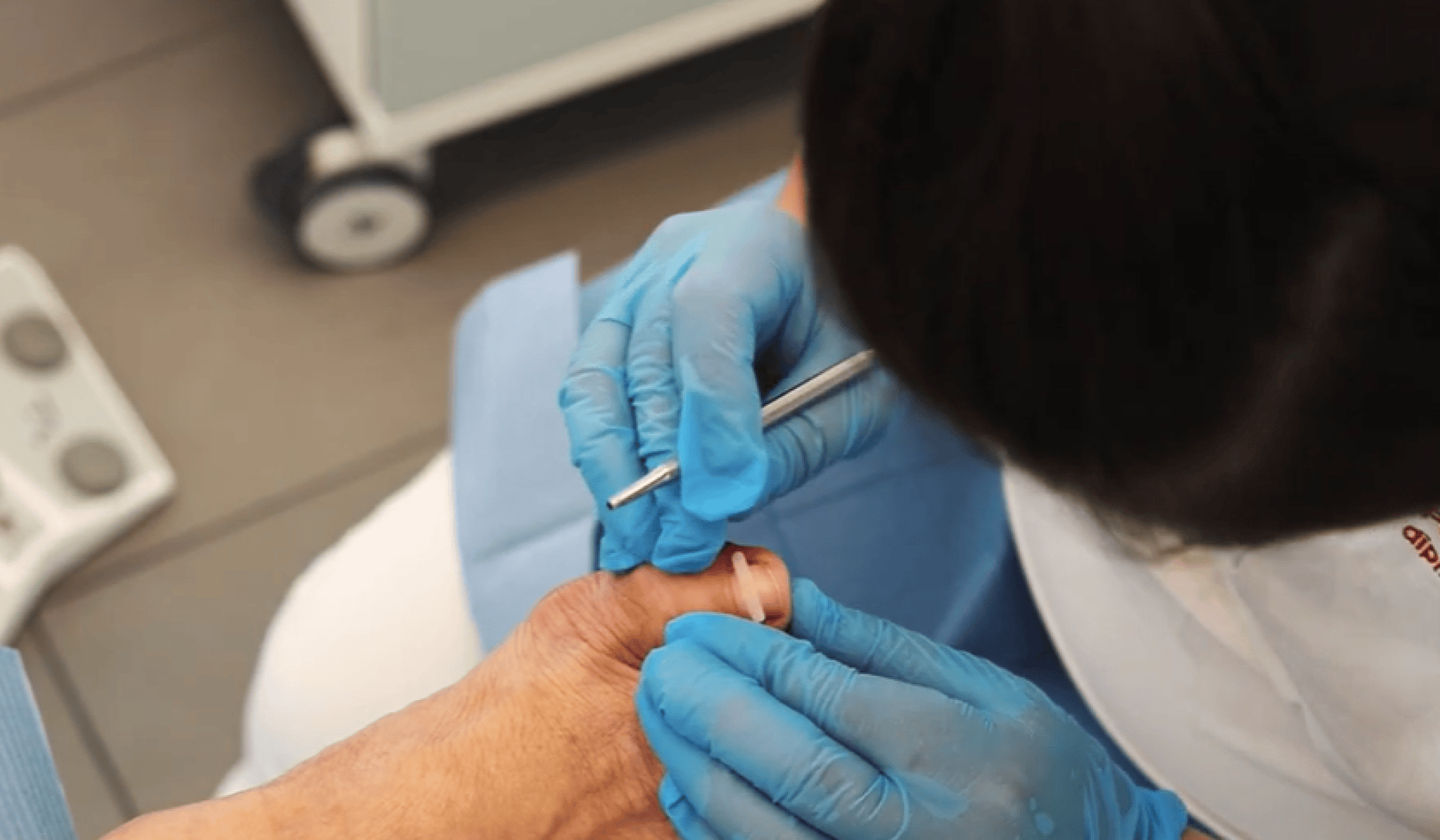 Ein Podologe mit blauen Handschuhen führt mit einem Metallinstrument einen Eingriff am großen Zeh eines Patienten durch.